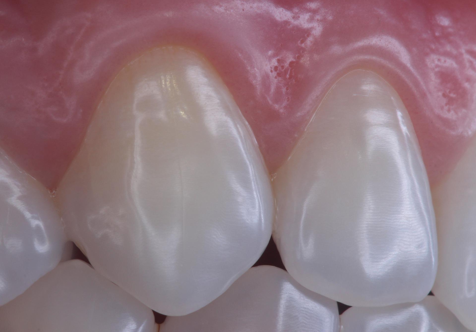 Gum disease treatment and care at Dental Botanica