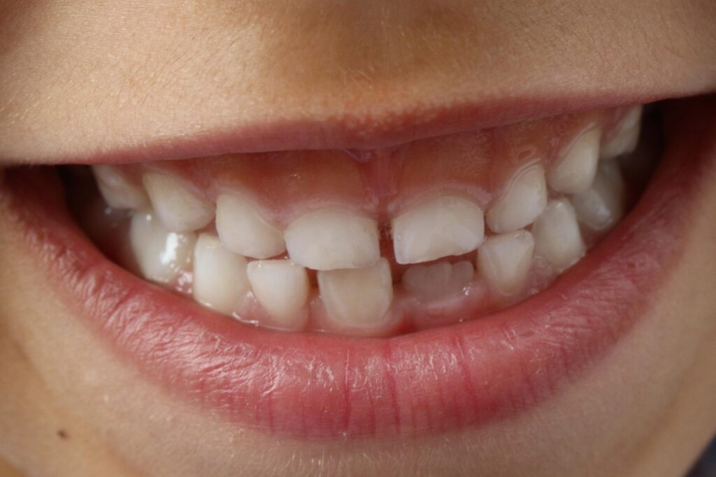 kids-dentistry-jammu.jpg Kids' dentistry services in Jammu at Dental Botanica